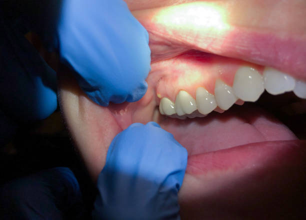 Best Urgent Dental Care for Toothache in Blossom, TX